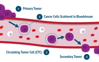 How cancer spread? – circulating tumour cells