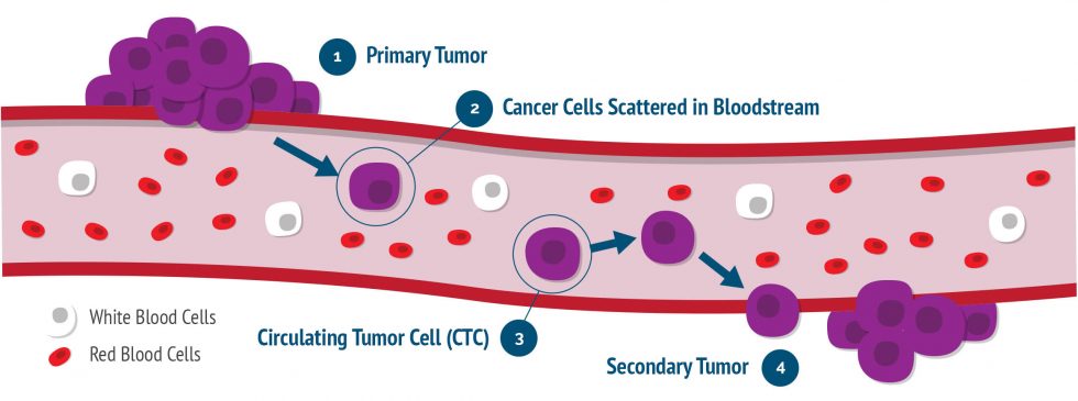 How cancer spread? – circulating tumour cells | NK Biocell